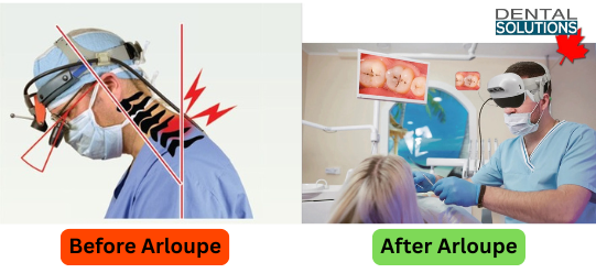 The Hidden Dangers of Poor Magnification: Why arLoupe is Essential for Every Dentist