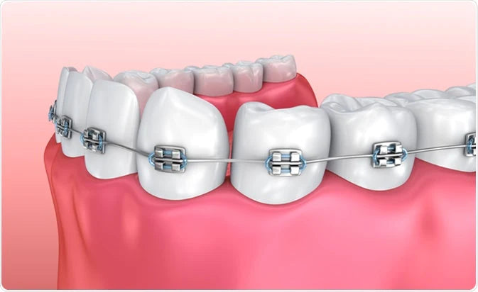 OrthoDontics Products