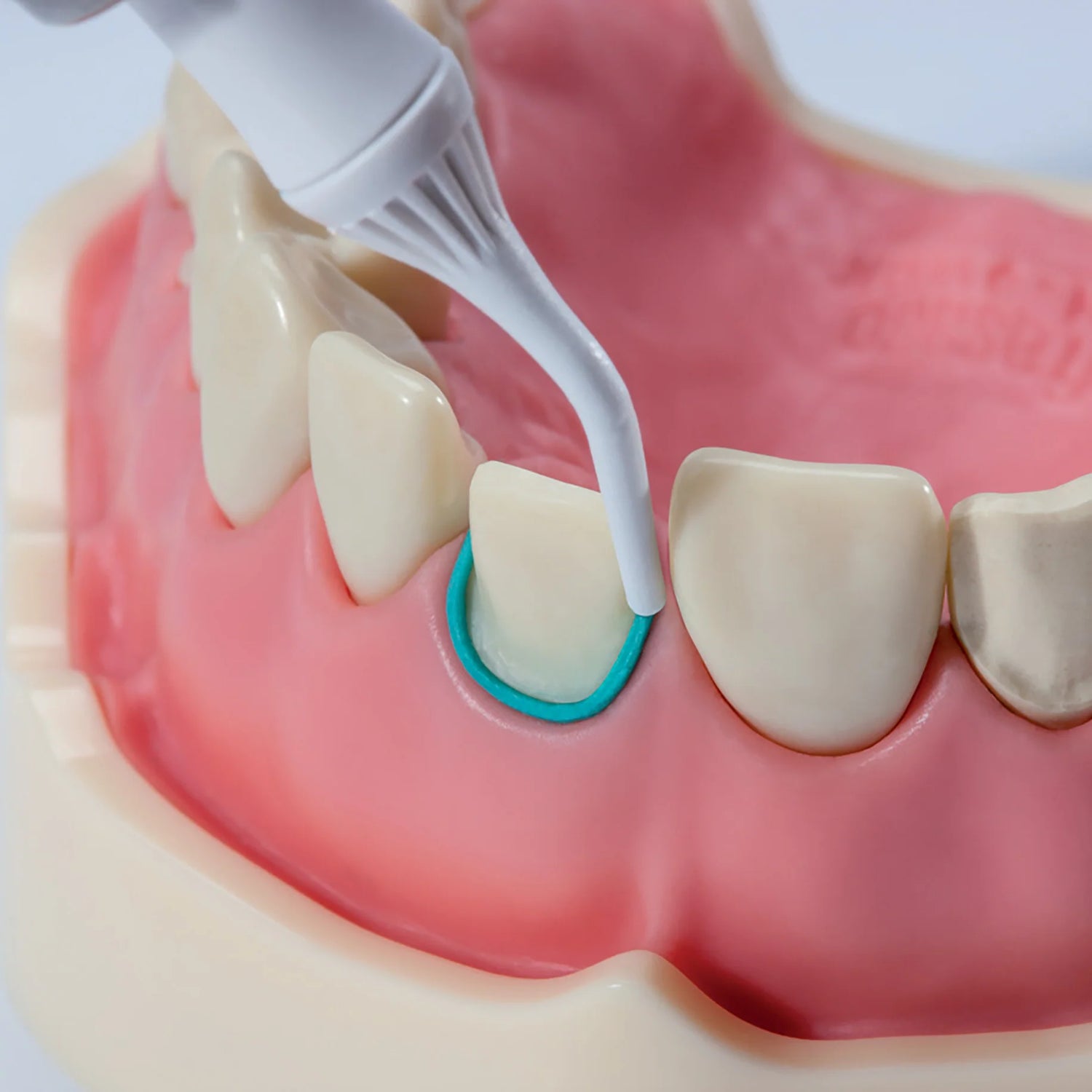 Retraction Materials