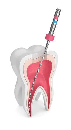 Endodontics, Root Canal Treatment