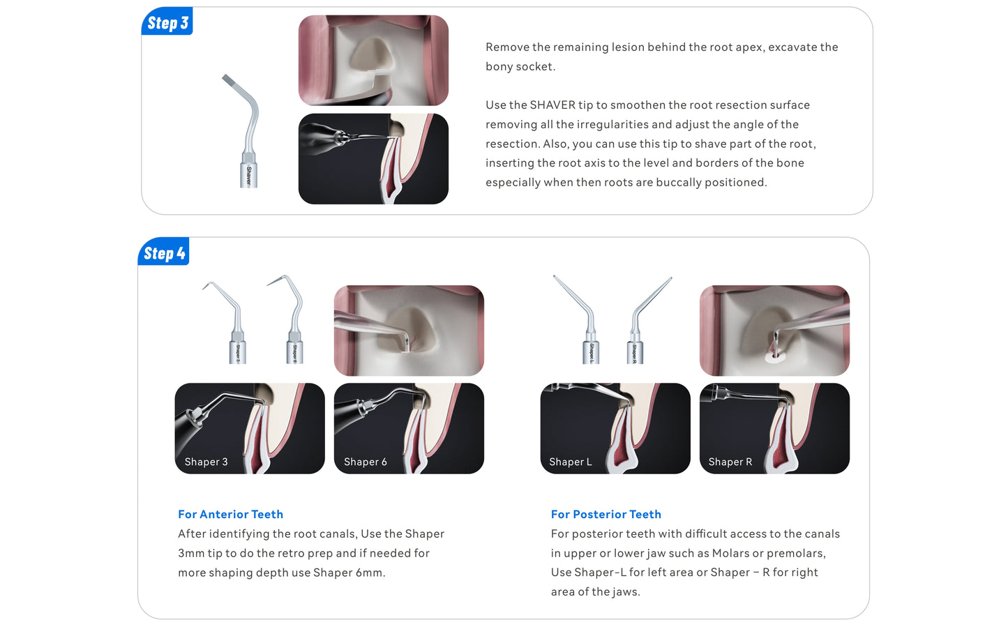 Woodpecker Altaqi Kit – Endo Piezo Surgery Tip Set