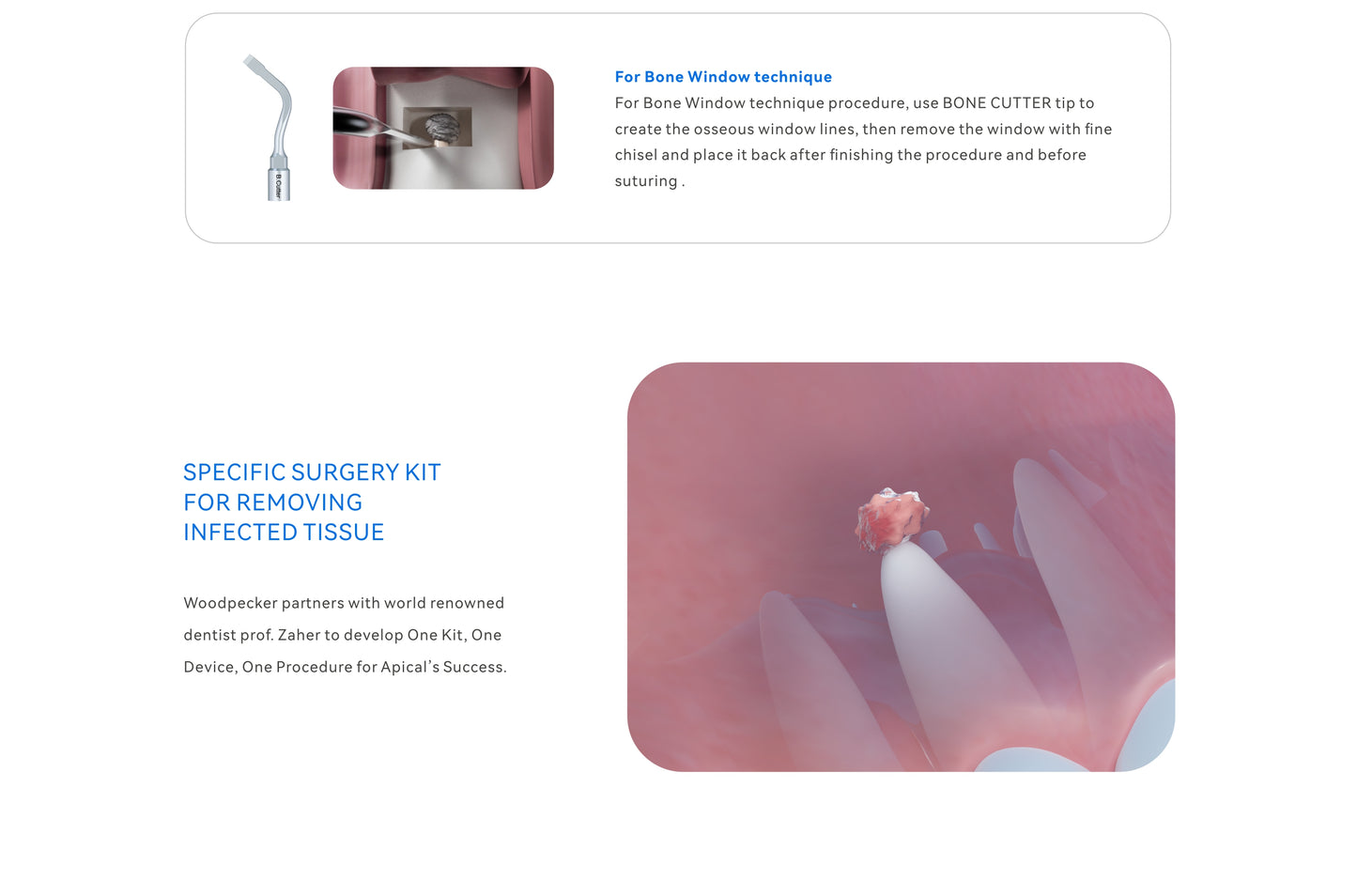 Woodpecker Altaqi Kit – Endo Piezo Surgery Tip Set
