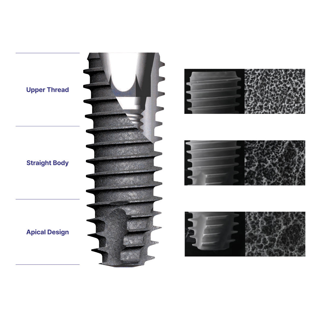 DIO UF(II) Regular Fixture – Dental Implant Fixture