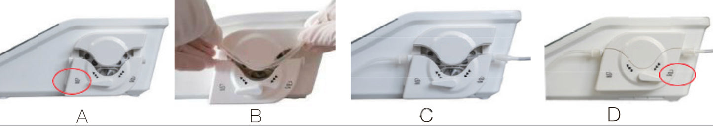 Woodpecker pump tube – Surgic Smart Machine Surgical Use