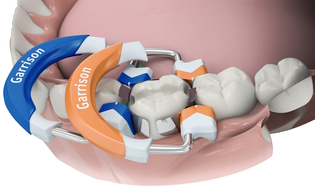 Garrison Ring Composi Tight 3D Fusion Matrix Rings 2/Pack (FX400-FX500-FX600) - Tall Orange 2/Pk