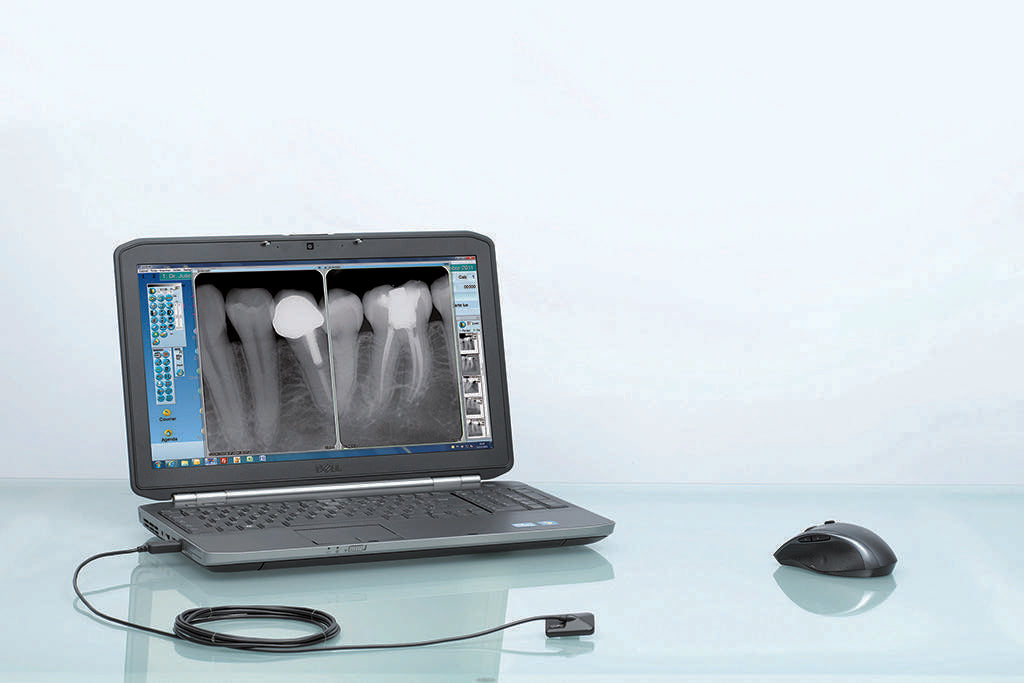 Owandy- OPTEO IntraOral Digital XRay Sensor Size #1