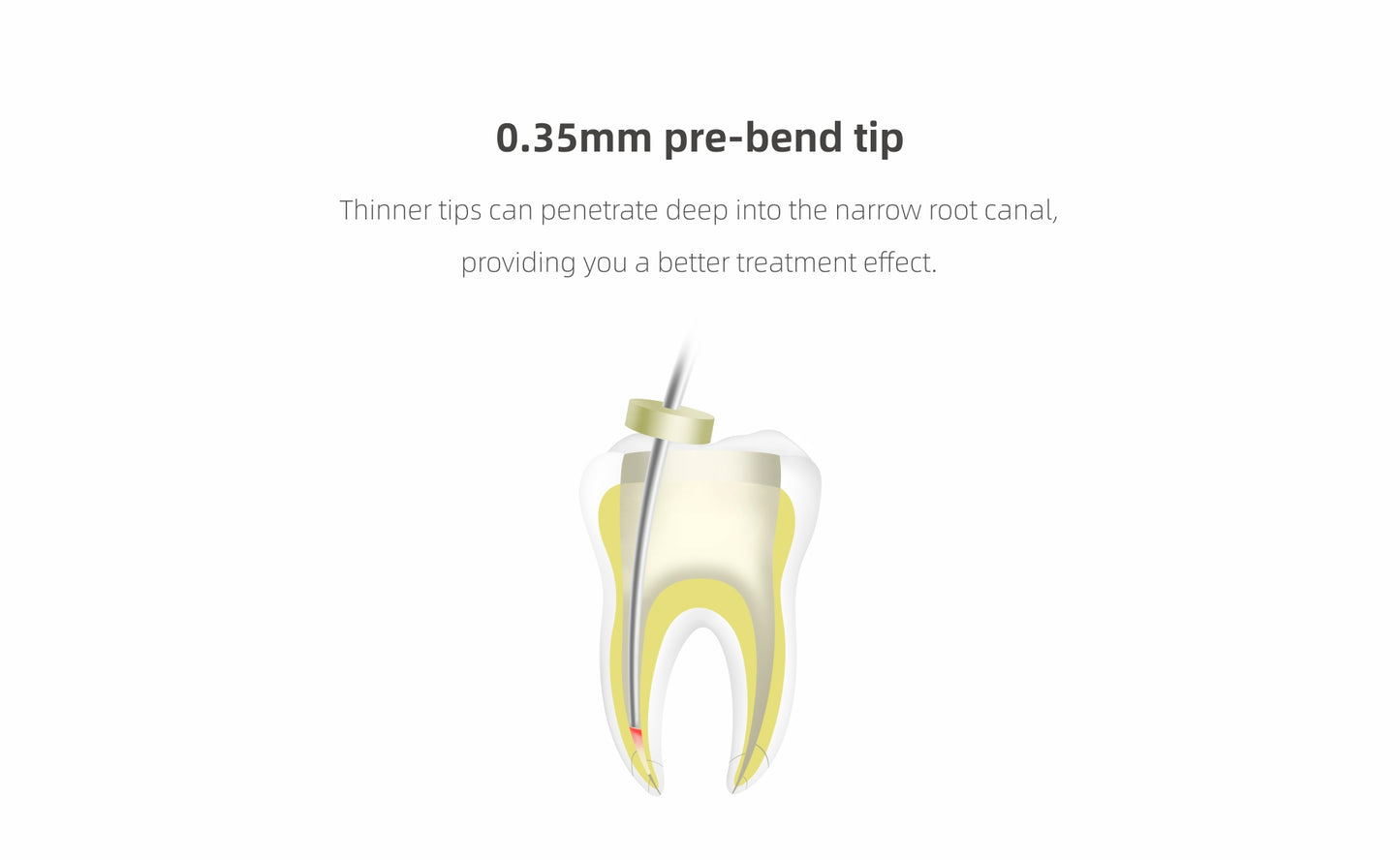 0.35mm pre-bend tip designed for deep penetration into narrow root canals, enhancing precision and treatment effectiveness in endodontic procedures.