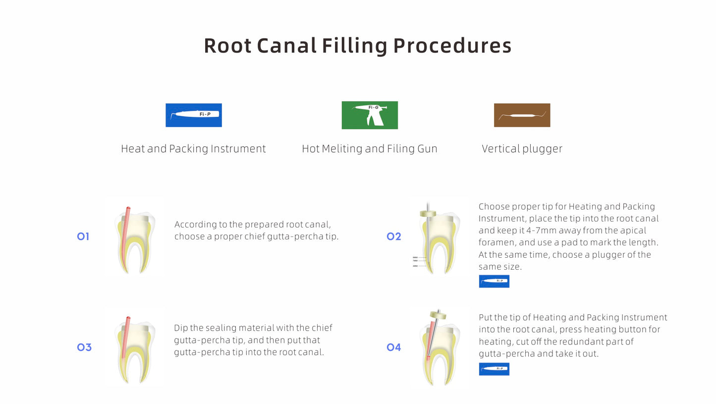 Step-by-step root canal filling procedure using the Woodpecker Fi-P gutta-percha obturation system. Includes heat and packing instrument, hot melting and filling gun, and vertical plugger for precise and efficient endodontic treatment.