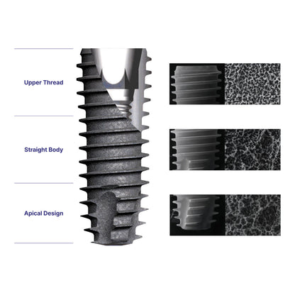 DIO UF(II) Regular Fixture – Dental Implant Fixture