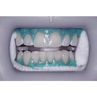 Kulzer Venus White Max light-cure gingival barrier 4 x 1.2 mL syringes