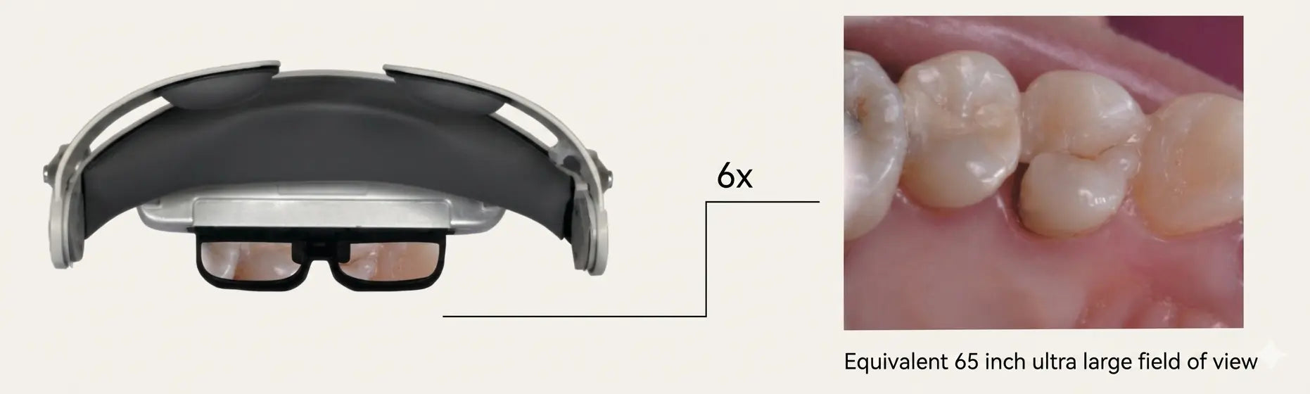 arLoupe WS3509 magnified digital view of dental treatment