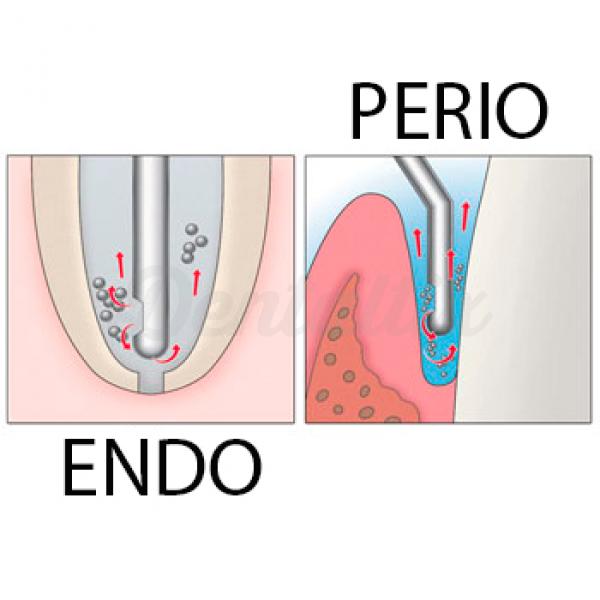 Endo Irrigation Syringes 100/Box (Compare to Max-i-Probe) Perio Irrigation Syringes - 30G 100/Box